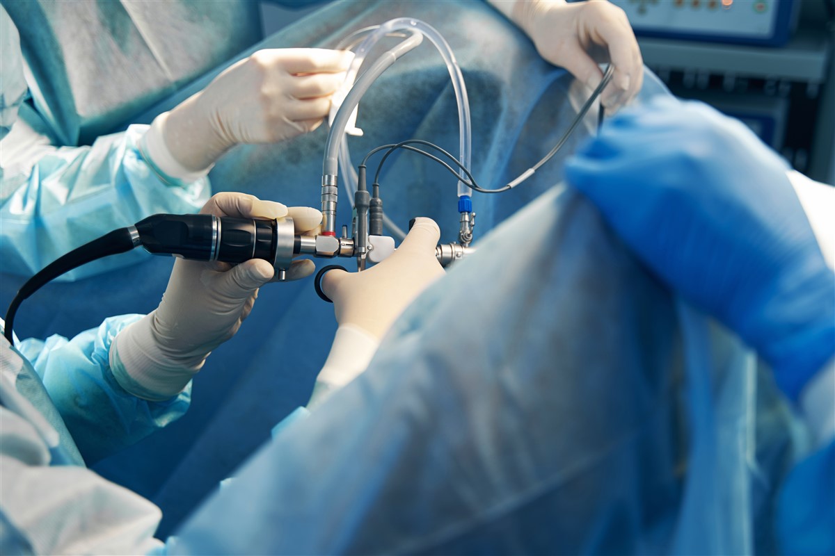 electrochirurgie et le temps de convalescence